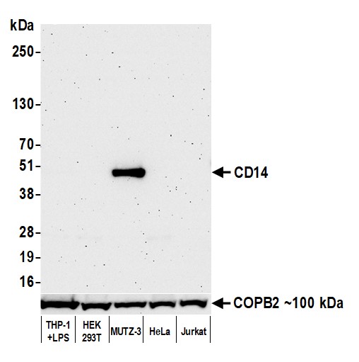 Western blot - Anti-CD14 antibody [BLR187J] - BSA free (AB314062), expandable thumbnail