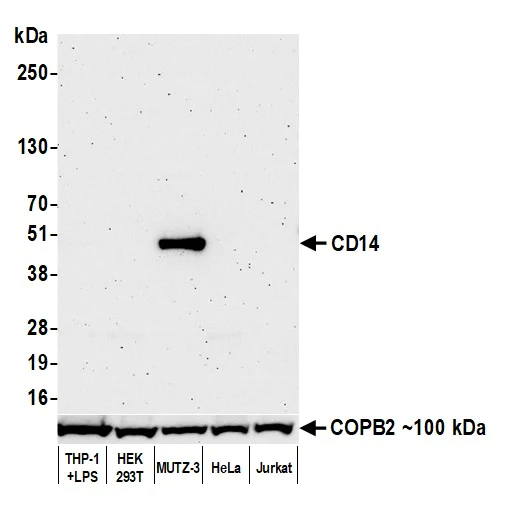 Western blot - Anti-CD14 antibody [BLR187J] - BSA free (AB314062)