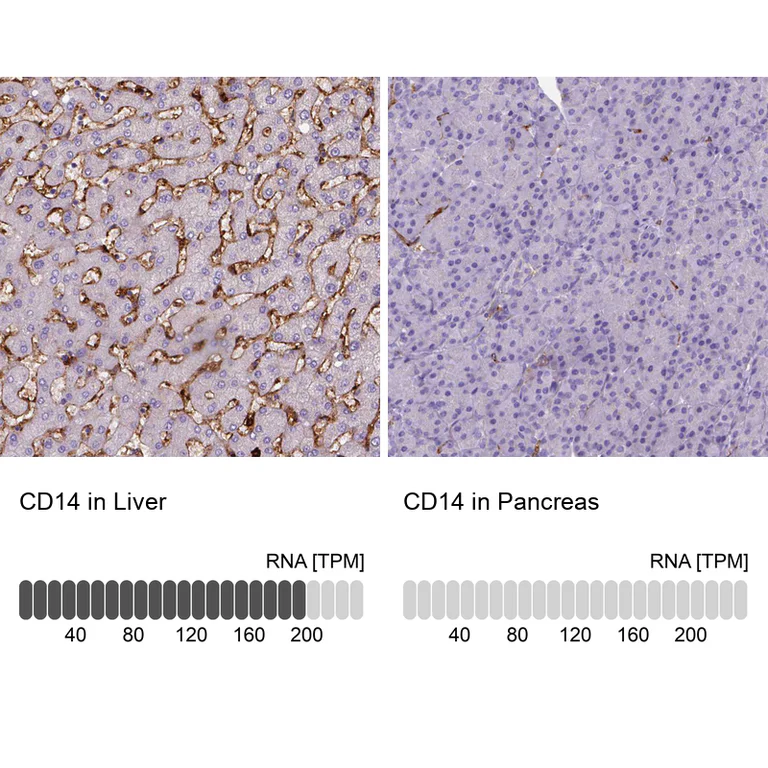 Immunohistochemistry (Formalin/PFA-fixed paraffin-embedded sections) - Anti-CD14 Antibody [CL1637] (AB327106)
