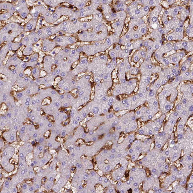 Immunohistochemistry (Formalin/PFA-fixed paraffin-embedded sections) - Anti-CD14 Antibody [CL1637] (AB327106)
