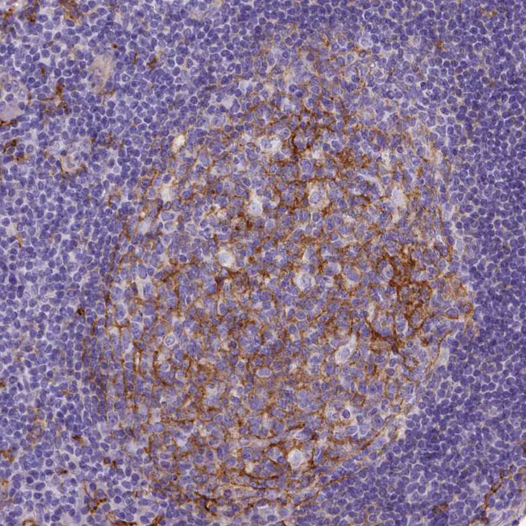 Immunohistochemistry (Formalin/PFA-fixed paraffin-embedded sections) - Anti-CD14 Antibody [CL1637] (AB327106)