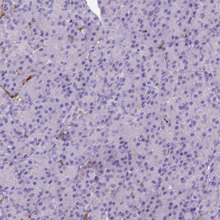 Immunohistochemistry (Formalin/PFA-fixed paraffin-embedded sections) - Anti-CD14 Antibody [CL1637] (AB327106)