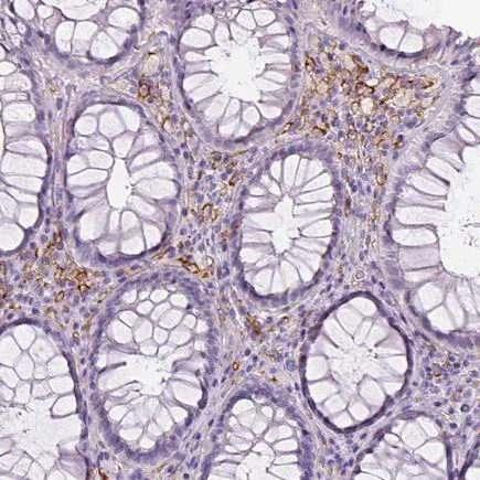 Immunohistochemistry (Formalin/PFA-fixed paraffin-embedded sections) - Anti-CD14 antibody [CL1638] (AB243040)