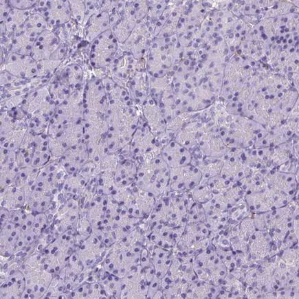 Immunohistochemistry (Formalin/PFA-fixed paraffin-embedded sections) - Anti-CD14 antibody [CL1638] (AB243040)