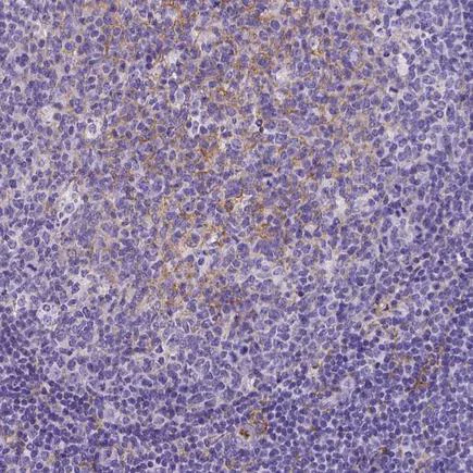Immunohistochemistry (Formalin/PFA-fixed paraffin-embedded sections) - Anti-CD14 antibody [CL1638] (AB243040)