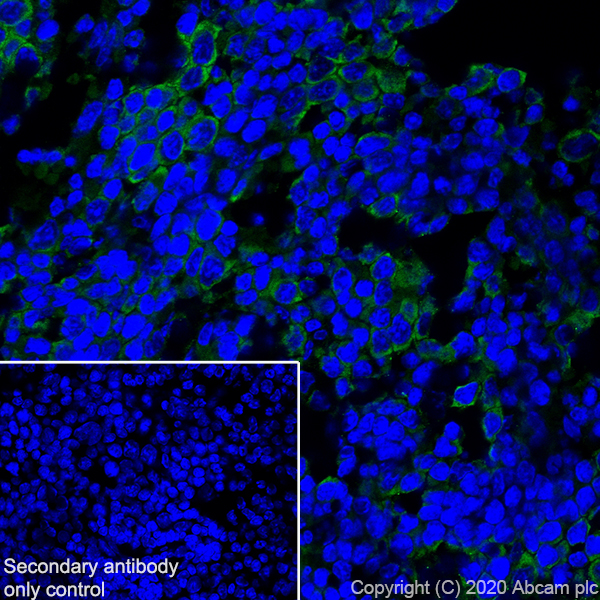 Immunohistochemistry (Frozen sections) - Anti-CD14 antibody [EPR21847] (AB221678)