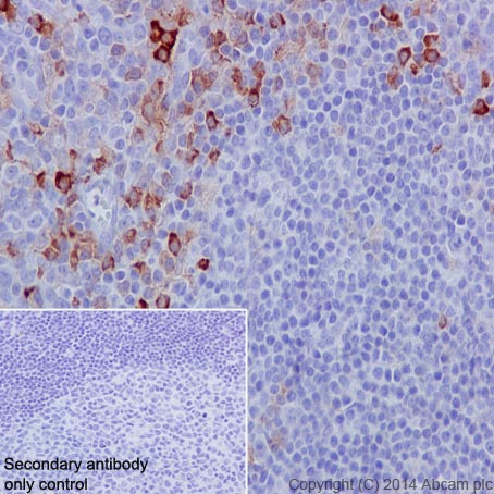 Immunohistochemistry (Formalin/PFA-fixed paraffin-embedded sections) - Anti-CD14 antibody [EPR3652] (AB133503), expandable thumbnail