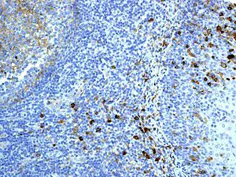 Immunohistochemistry (Formalin/PFA-fixed paraffin-embedded sections) - Anti-CD14 antibody [EPR3652] (AB133503)