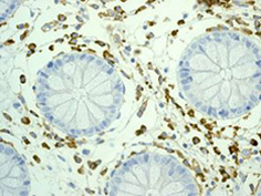 Immunohistochemistry (Formalin/PFA-fixed paraffin-embedded sections) - Anti-CD14 antibody [EPR3652] - BSA and Azide free (AB209971)
