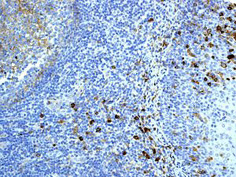 Immunohistochemistry (Formalin/PFA-fixed paraffin-embedded sections) - Anti-CD14 antibody [EPR3652] - BSA and Azide free (AB209971)