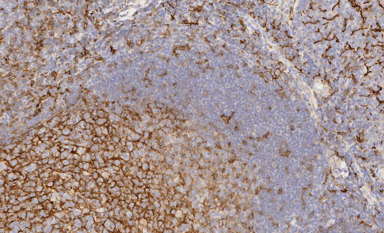 Immunohistochemistry (Formalin/PFA-fixed paraffin-embedded sections) - Anti-CD14 antibody [EPR3653] (AB133335)
