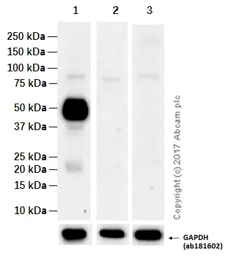 Western blot - Anti-CD14 antibody [EPR3653] (AB133335)