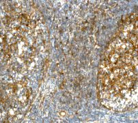 Immunohistochemistry (Formalin/PFA-fixed paraffin-embedded sections) - Anti-CD14 antibody [EPR3653] - Low endotoxin, Azide free (AB214438)