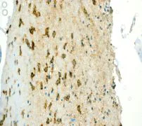Immunohistochemistry (Formalin/PFA-fixed paraffin-embedded sections) - Anti-CD14 antibody [EPR3653] - Low endotoxin, Azide free (AB214438)