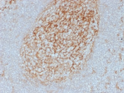 Immunohistochemistry (Formalin/PFA-fixed paraffin-embedded sections) - Anti-CD14 antibody [LPSR/2385] - BSA and Azide free (AB237942)