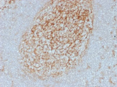 Immunohistochemistry (Formalin/PFA-fixed paraffin-embedded sections) - Anti-CD14 antibody [LPSR/2385] - BSA and Azide free (AB237942)
