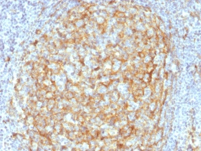Immunohistochemistry (Formalin/PFA-fixed paraffin-embedded sections) - Anti-CD14 antibody [LPSR/2386] - BSA and Azide free (AB237943)
