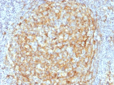 Immunohistochemistry (Formalin/PFA-fixed paraffin-embedded sections) - Anti-CD14 antibody [LPSR/2386] - BSA and Azide free (AB237943)