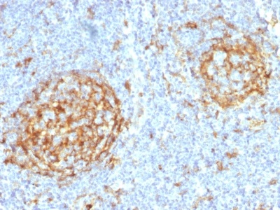 Immunohistochemistry (Formalin/PFA-fixed paraffin-embedded sections) - Anti-CD14 antibody [LPSR/2397] - BSA and Azide free (AB237944)