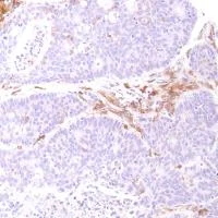 Immunohistochemistry (Formalin/PFA-fixed paraffin-embedded sections) - Anti-CD14 antibody [SP192] (AB183322)