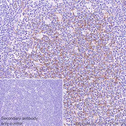 Immunohistochemistry (Formalin/PFA-fixed paraffin-embedded sections) - Anti-CD14 antibody [SP192] (AB183322)