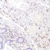 Immunohistochemistry (Formalin/PFA-fixed paraffin-embedded sections) - Anti-CD14 antibody [SP192] (AB183322)