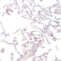 Immunohistochemistry (Formalin/PFA-fixed paraffin-embedded sections) - Anti-CD14 antibody [SP192] (AB183322)