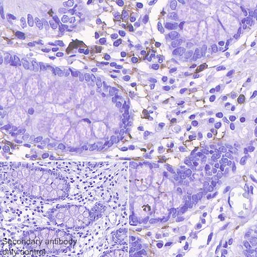 Immunohistochemistry (Formalin/PFA-fixed paraffin-embedded sections) - Anti-CD14 antibody [SP192] (AB183322)