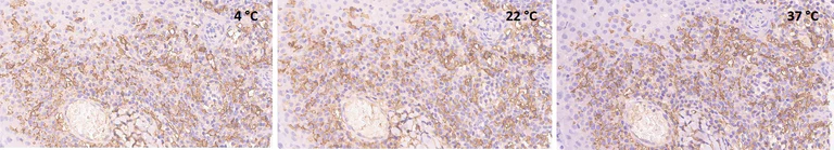 Immunohistochemistry (Formalin/PFA-fixed paraffin-embedded sections) - Anti-CD14 antibody [SP192] (AB183322)