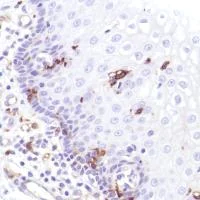 Immunohistochemistry (Formalin/PFA-fixed paraffin-embedded sections) - Anti-CD14 antibody [SP192] (AB183322)