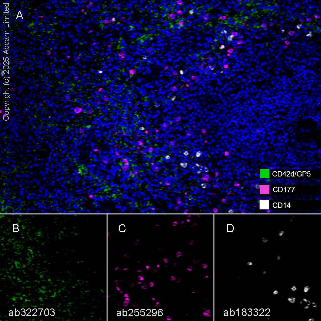 Multiplex immunohistochemistry - Anti-CD14 antibody [SP192] (AB183322)