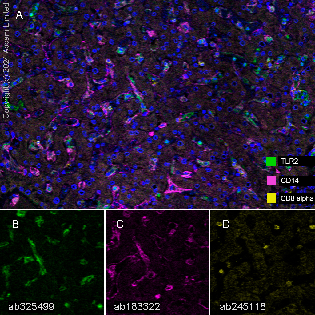 Multiplex immunohistochemistry - Anti-CD14 antibody [SP192] (AB183322)