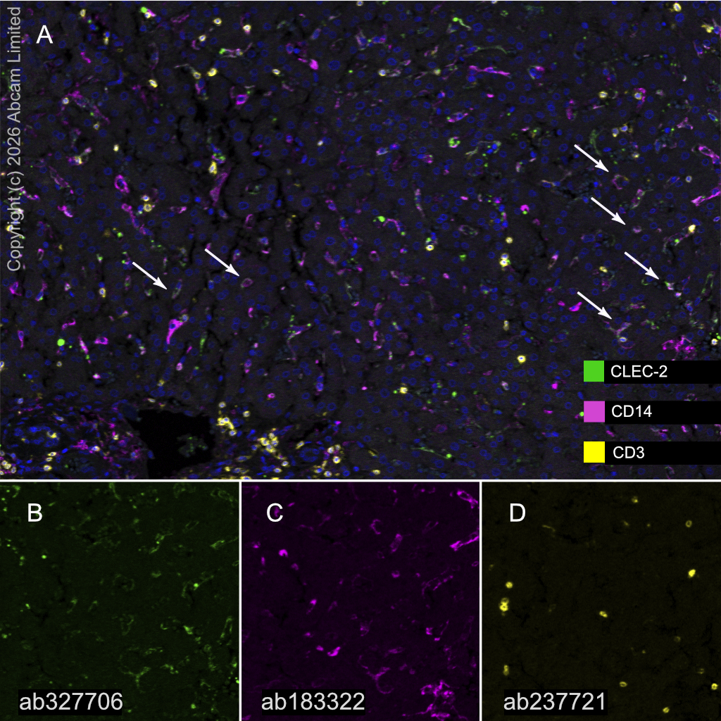 Multiplex immunohistochemistry - Anti-CD14 antibody [SP192] (AB183322)