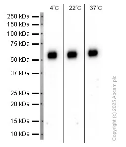 Western blot - Anti-CD14 antibody [SP192] (AB183322)