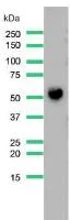 Western blot - Anti-CD14 antibody [SP192] (AB183322)