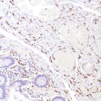 Immunohistochemistry (Formalin/PFA-fixed paraffin-embedded sections) - Anti-CD14 antibody [SP192] - BSA and Azide free (ab230903), expandable thumbnail