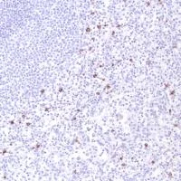 Immunohistochemistry (Formalin/PFA-fixed paraffin-embedded sections) - Anti-CD14 antibody [SP192] - BSA and Azide free (AB230903)