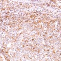 Immunohistochemistry (Formalin/PFA-fixed paraffin-embedded sections) - Anti-CD14 antibody [SP192] - BSA and Azide free (ab230903), expandable thumbnail