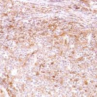 Immunohistochemistry (Formalin/PFA-fixed paraffin-embedded sections) - Anti-CD14 antibody [SP192] - BSA and Azide free (AB230903)