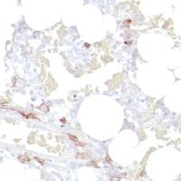 Immunohistochemistry (Formalin/PFA-fixed paraffin-embedded sections) - Anti-CD14 antibody [SP192] - BSA and Azide free (AB230903), expandable thumbnail