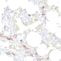 Immunohistochemistry (Formalin/PFA-fixed paraffin-embedded sections) - Anti-CD14 antibody [SP192] - BSA and Azide free (AB230903)
