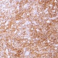 Immunohistochemistry (Formalin/PFA-fixed paraffin-embedded sections) - Anti-CD14 antibody [SP192] - BSA and Azide free (ab230903), expandable thumbnail