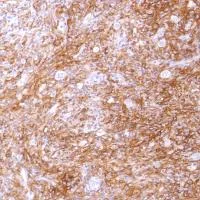 Immunohistochemistry (Formalin/PFA-fixed paraffin-embedded sections) - Anti-CD14 antibody [SP192] - BSA and Azide free (AB230903)