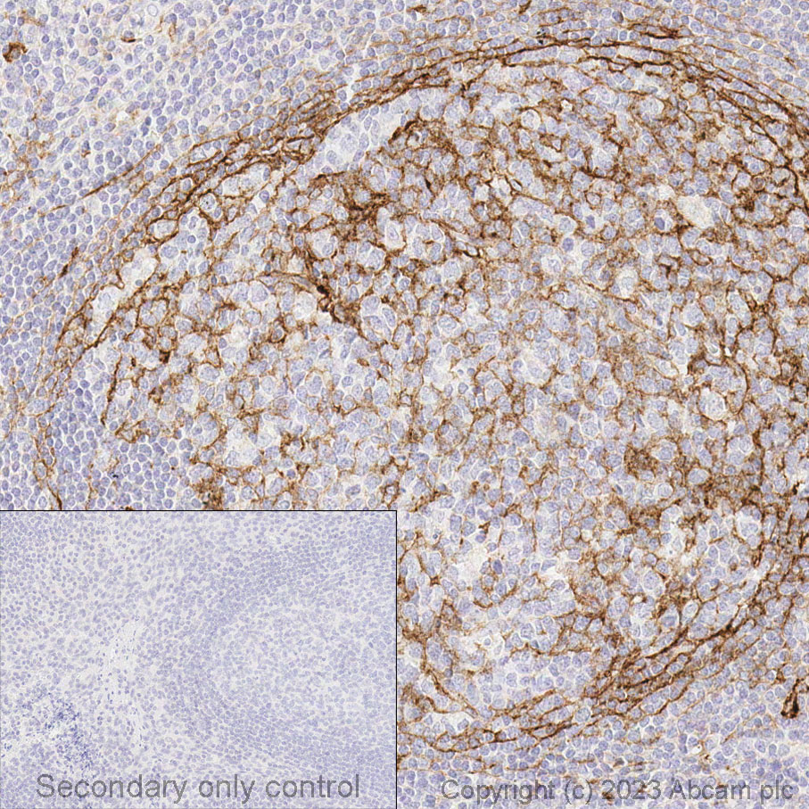 Immunohistochemistry (Formalin/PFA-fixed paraffin-embedded sections) - Anti-CD14 antibody [SP192] - BSA and Azide free (ab230903), expandable thumbnail