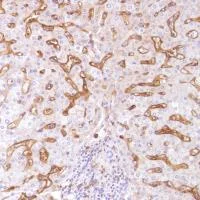 Immunohistochemistry (Formalin/PFA-fixed paraffin-embedded sections) - Anti-CD14 antibody [SP192] - BSA and Azide free (AB230903)