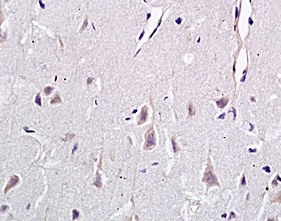 Immunohistochemistry (Formalin/PFA-fixed paraffin-embedded sections) - Anti-CD146 antibody (AB203118), expandable thumbnail