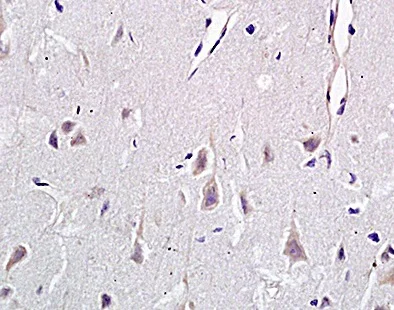 Immunohistochemistry (Formalin/PFA-fixed paraffin-embedded sections) - Anti-CD146 antibody (AB203118)
