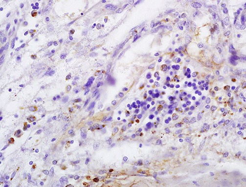 Immunohistochemistry (Formalin/PFA-fixed paraffin-embedded sections) - Anti-CD146 antibody (AB203118), expandable thumbnail