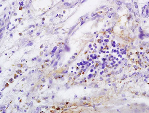 Immunohistochemistry (Formalin/PFA-fixed paraffin-embedded sections) - Anti-CD146 antibody (AB203118)