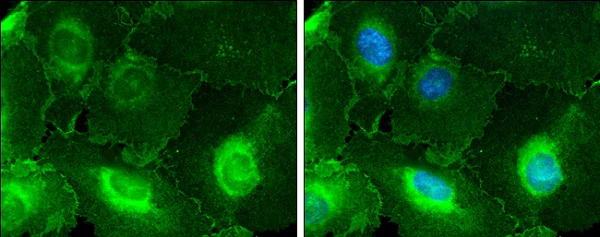 Immunocytochemistry/ Immunofluorescence - Anti-CD146 antibody - C-terminal (AB228540)